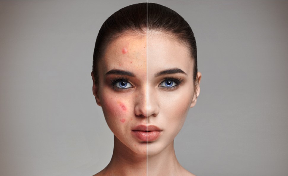 every information about beauty retouch